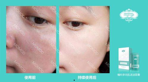 男士网红洁面膏,深层清洁，焕发肌肤光彩的秘密武器